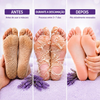 Máscara para Calos e Calcanhares Rachados